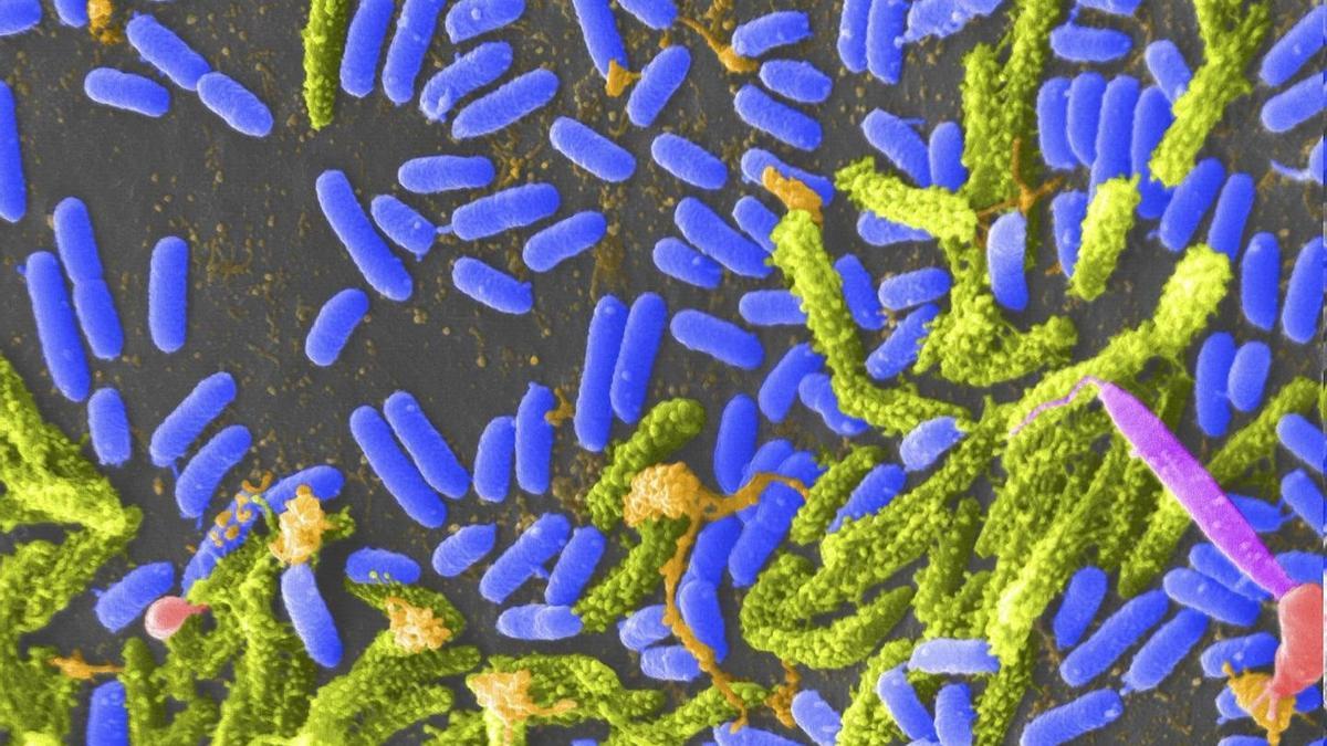 Bacteria Vibrio Puede Causar Cólera En Humanos.