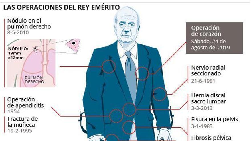 Todas las operaciones de Juan Carlos I