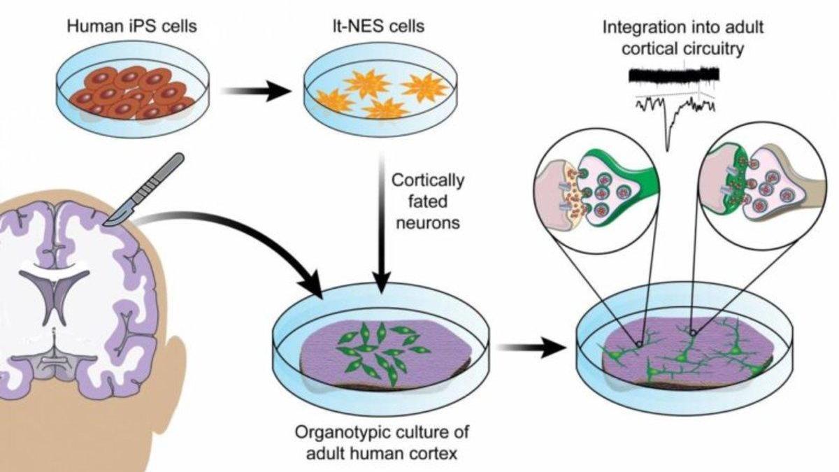 Crean neuronas que se pueden integrar en tejido cerebral humano