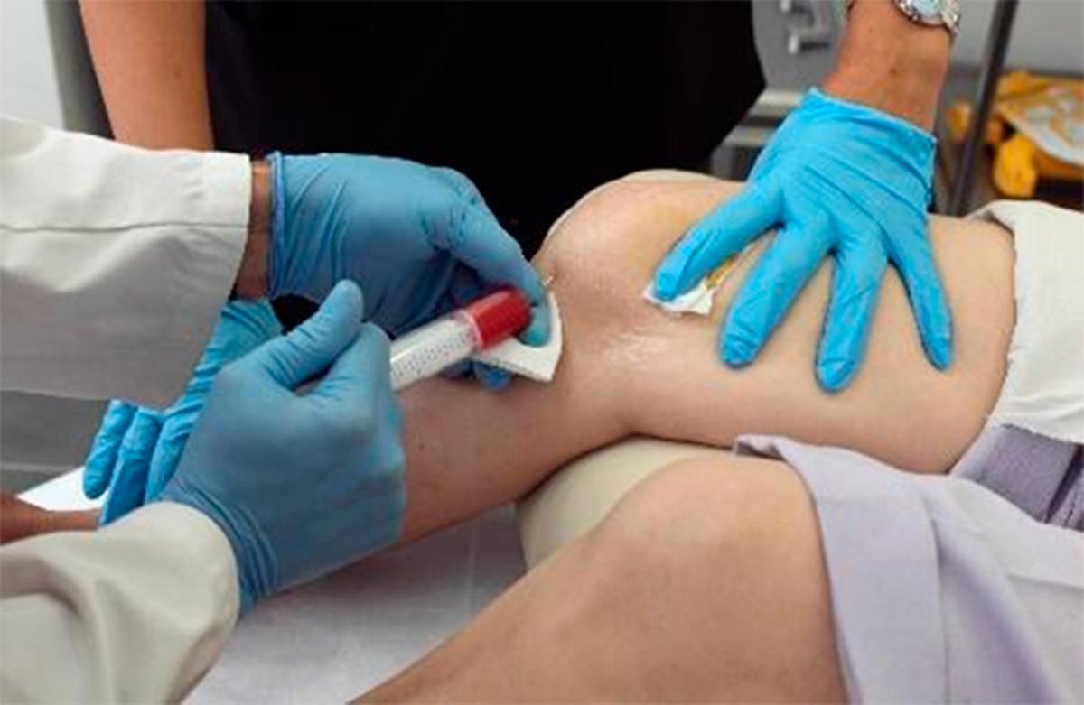 La Medicina Regenerativa como alternativa a la cirugía en el tratamiento de la artrosis y los dolores articulares