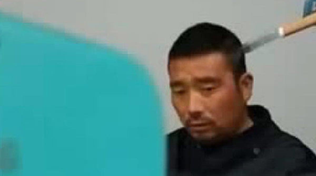 Un chino espera paciente en un hospital con un cuchillo en la cabeza