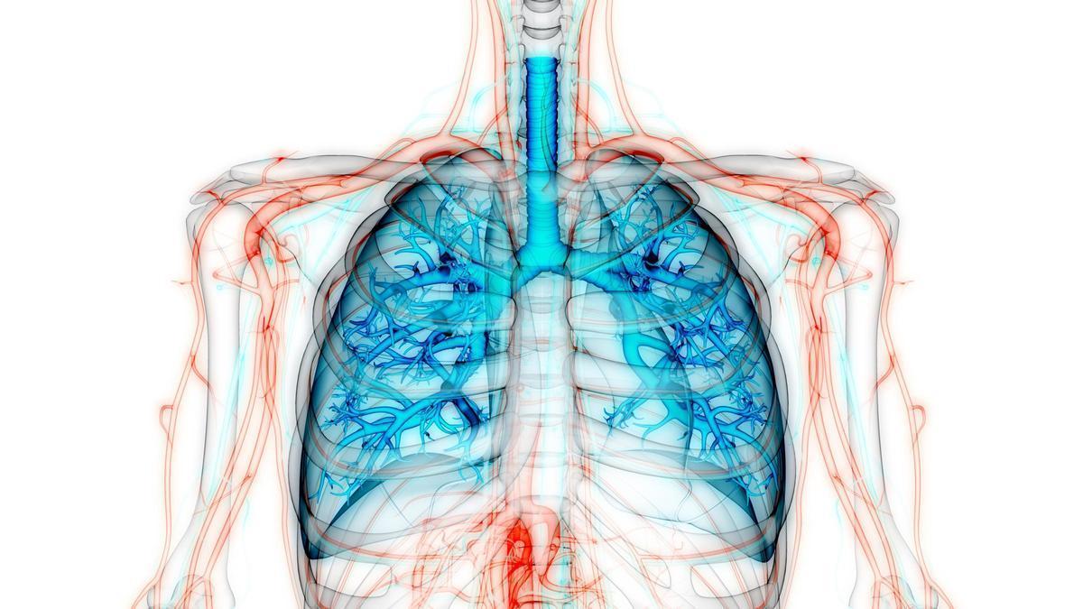 Fibrosi pulmonar