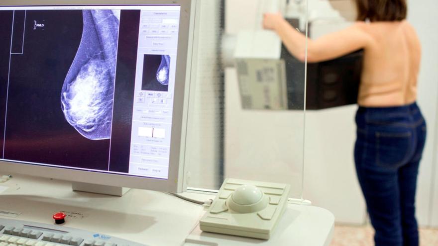 Una dona durant una mamografia