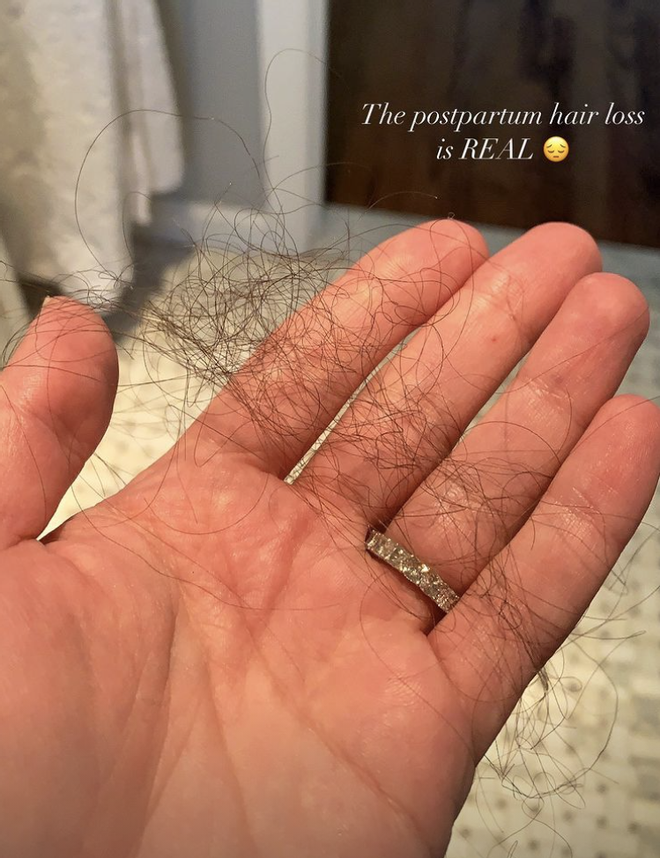 Lea Michelle muestra la pérdida de pelo tras el posparto