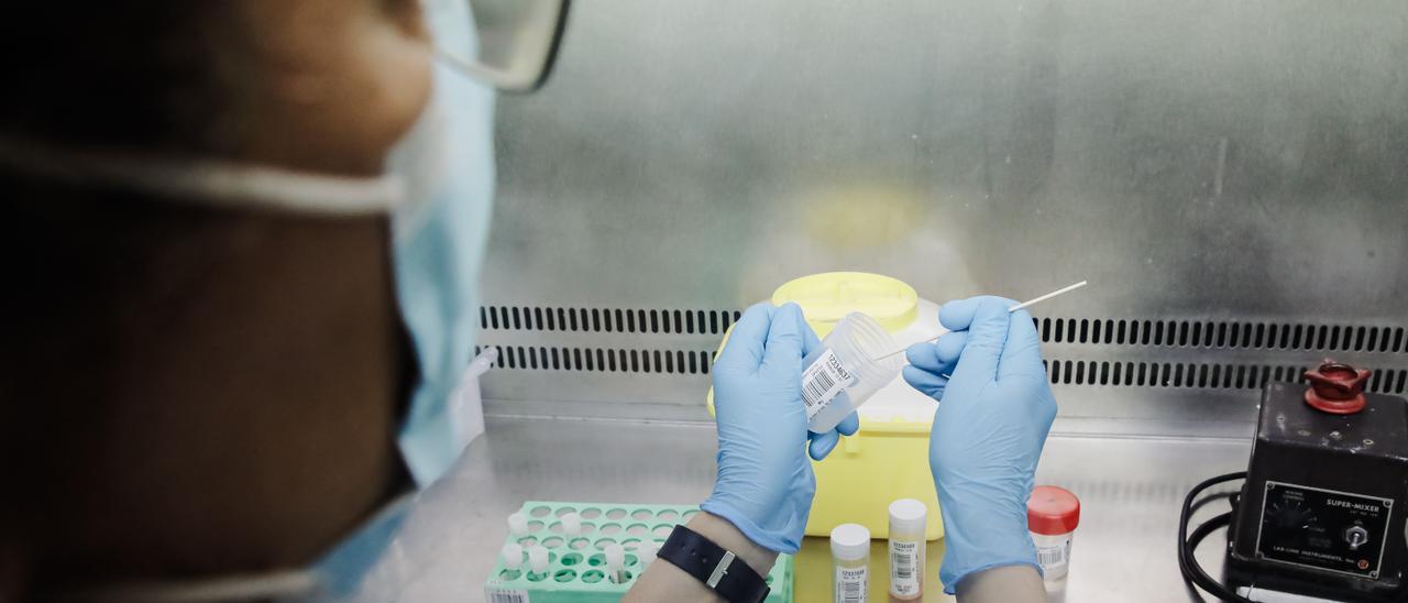 Una técnico de laboratorio sostiene una de las pruebas de análisis para la viruela del mono, en el Hospital Ramón y Cajal, a 30 de mayo de 2022, en Madrid (España). La Comunidad de Madrid empieza hoy a realizar en cinco hospitales públicos de la región la