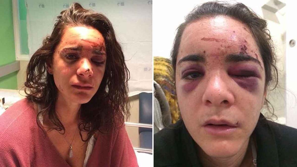 Violada y brutalmente golpeada una joven estudiante de EEUU en Madrid.