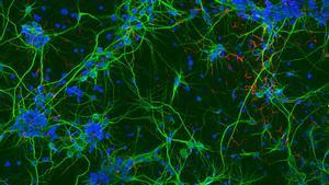 Las redes neurales crecen bajo campos magnéticos alternos de alta frecuencia