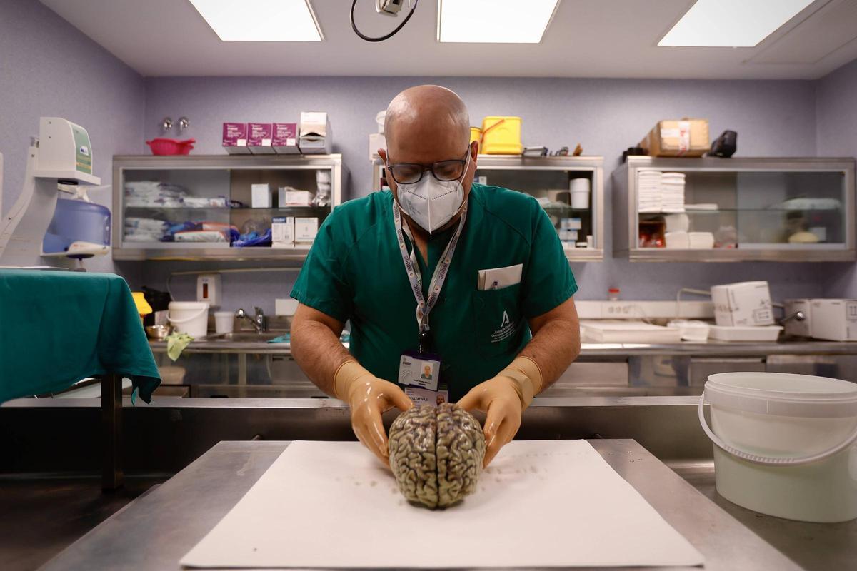 El doctor Rafael Sánchez, con un cerebro donado al nodo existente en el hospital Reina Sofía.