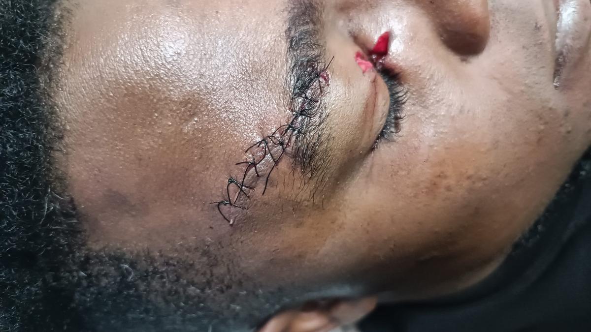 Heridas de una de las víctimas