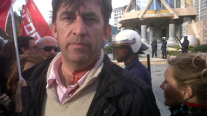 Herido en el enfrentamiento entre la policía y los manifestantes
