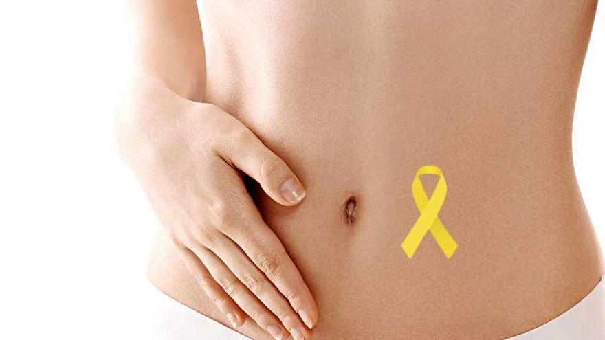 Endometriosis, la enfermedad silenciosa