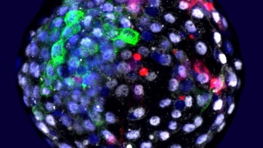 Ya hay al menos tres modelos de embriones humanos sintéticos