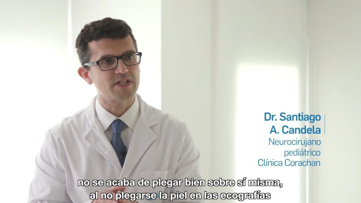 ¿Qué es la espina bífida? Síntomas y tratamiento de esta enfermedad