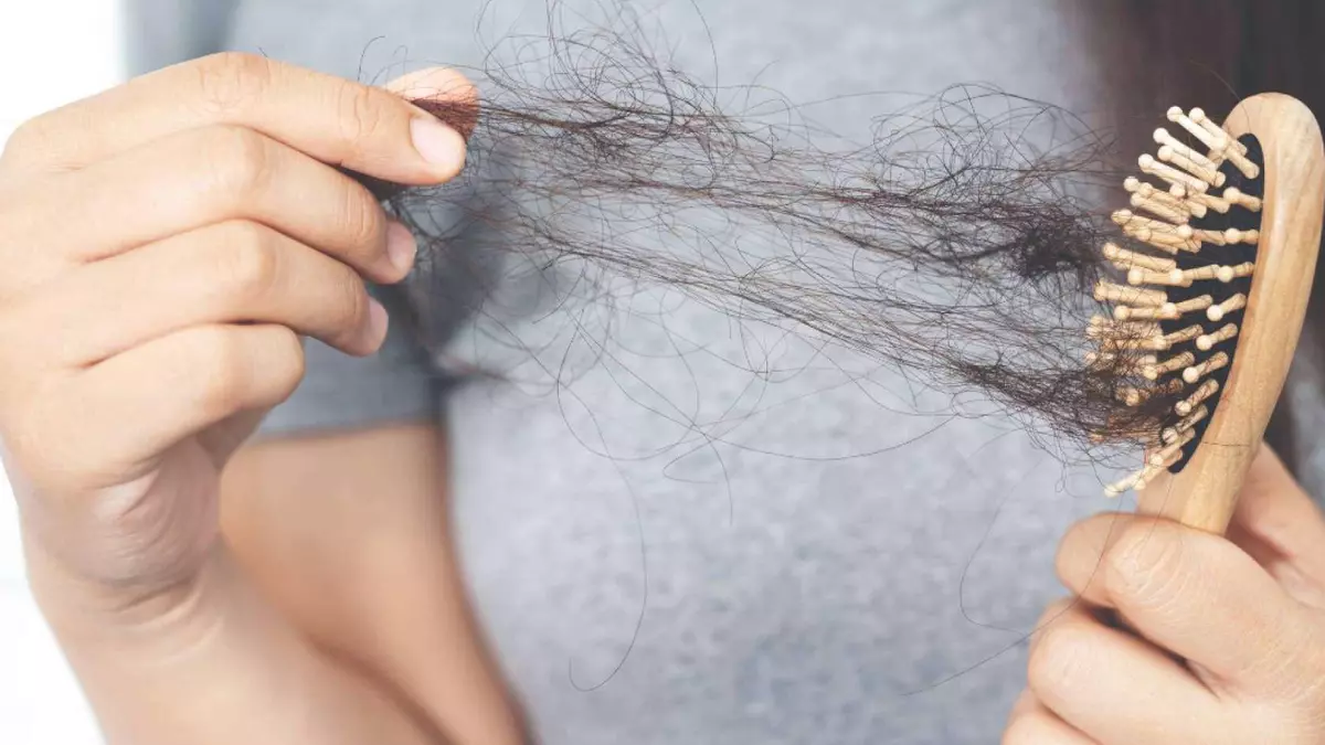 ¿Empiezas a perder cabello? Estos son los primeros signos de calvicie en mujeres