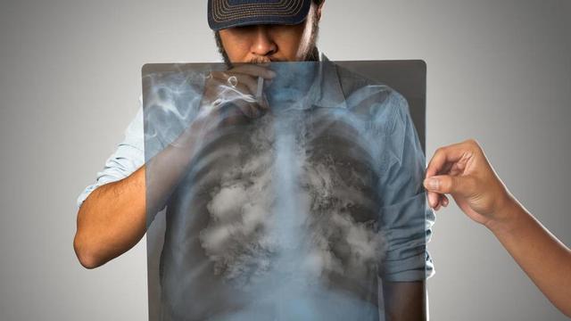 El tabaco provoca daños en los huesos.