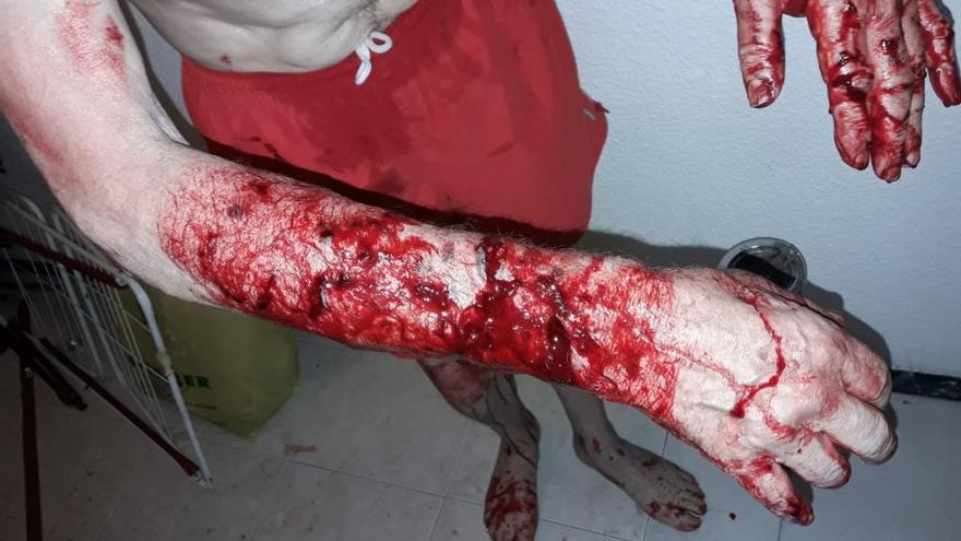 La Policía rescata en Elche a dos personas atacadas por su perro de raza peligrosa