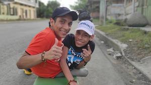 Los hermanos siameses de Ecuador