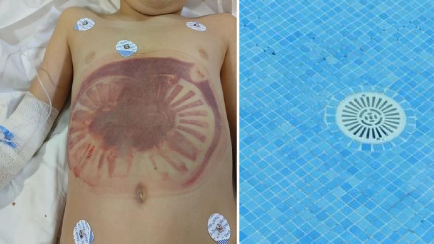 Terrible susto en Córdoba: un niño es succionado por la depuradora de su piscina