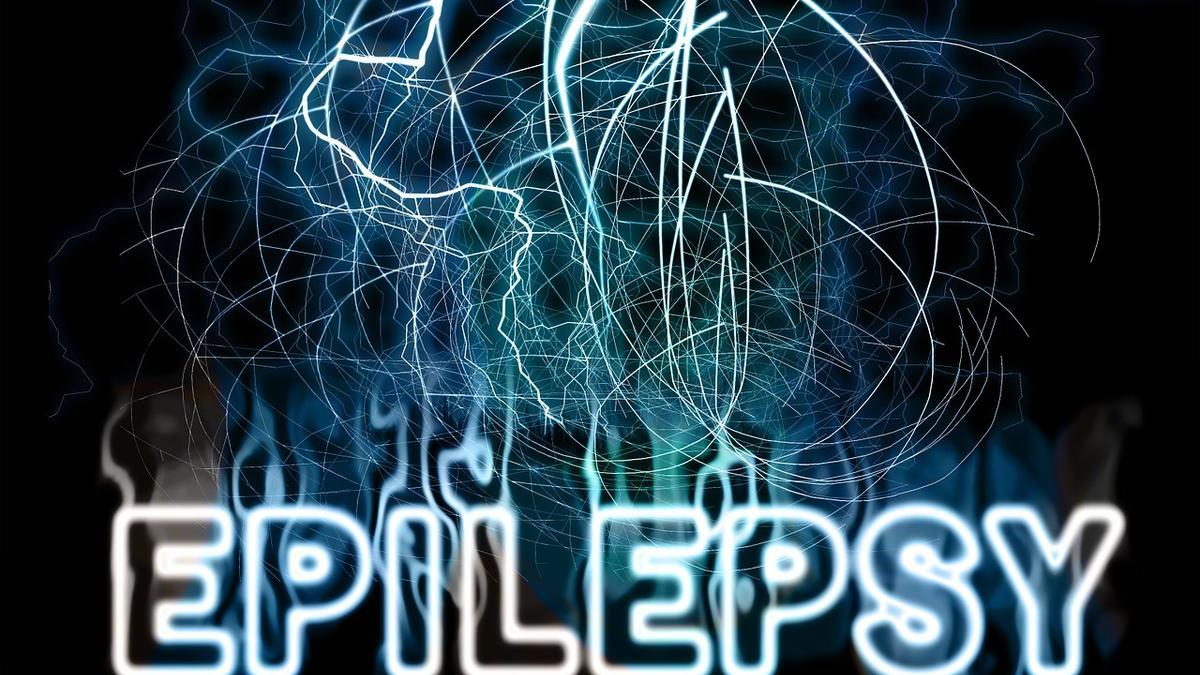 Creación artística de la epilepsia en el cerebro.