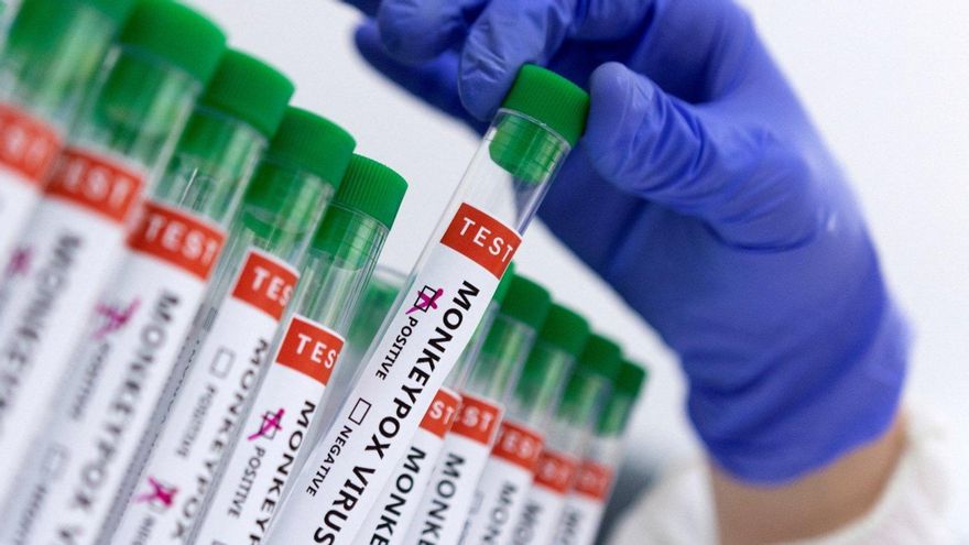 Salud intensifica la vigilancia epidemiológica de la viruela del mono