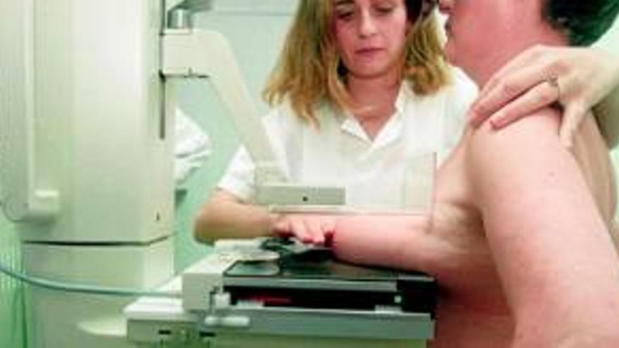 El SES cita a 124 mujeres para hacerse en julio una mamografía
