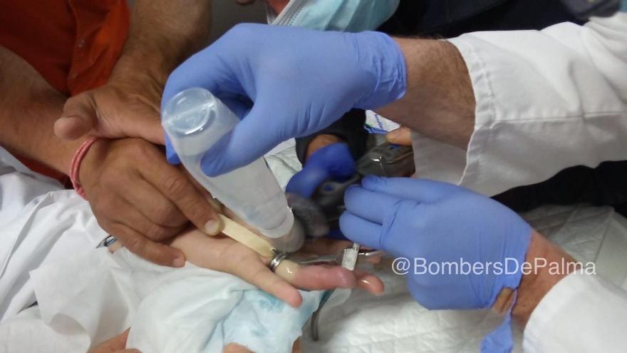 Momento en el que un bombero corta el anillo del adolescente.