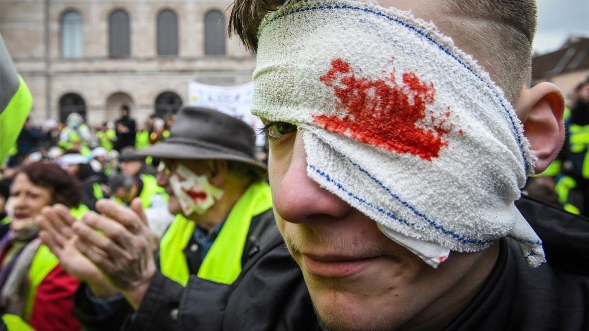 Los chalecos amarillos, con heridas falsas en los ojos, durante una manifestación.