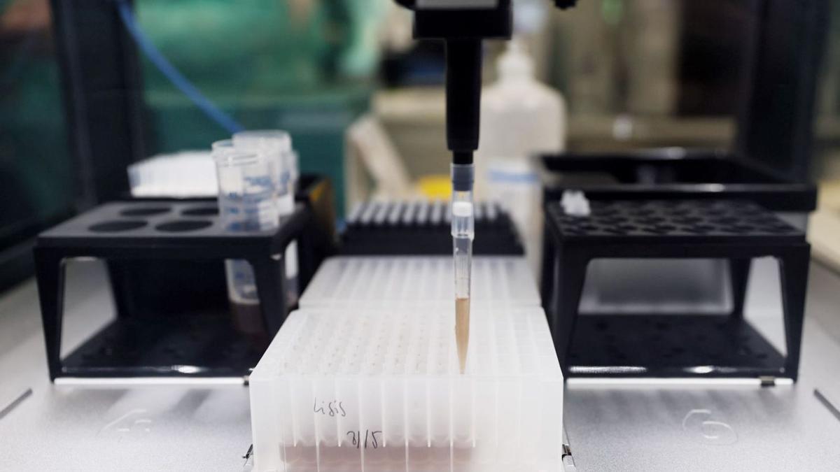 Pruebas PCR para la viruela del mono en el Hospital Gregorio Marañón de Madrid. | | EUROPA PRESS