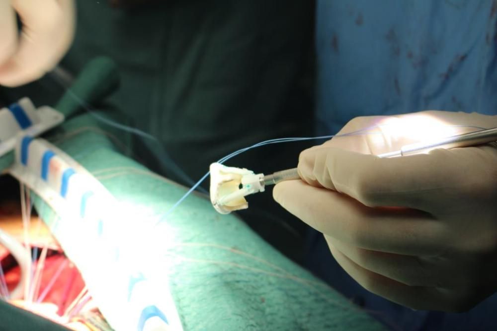 Operació pionera al Trueta per implantar una vàlvula cardíaca biològica