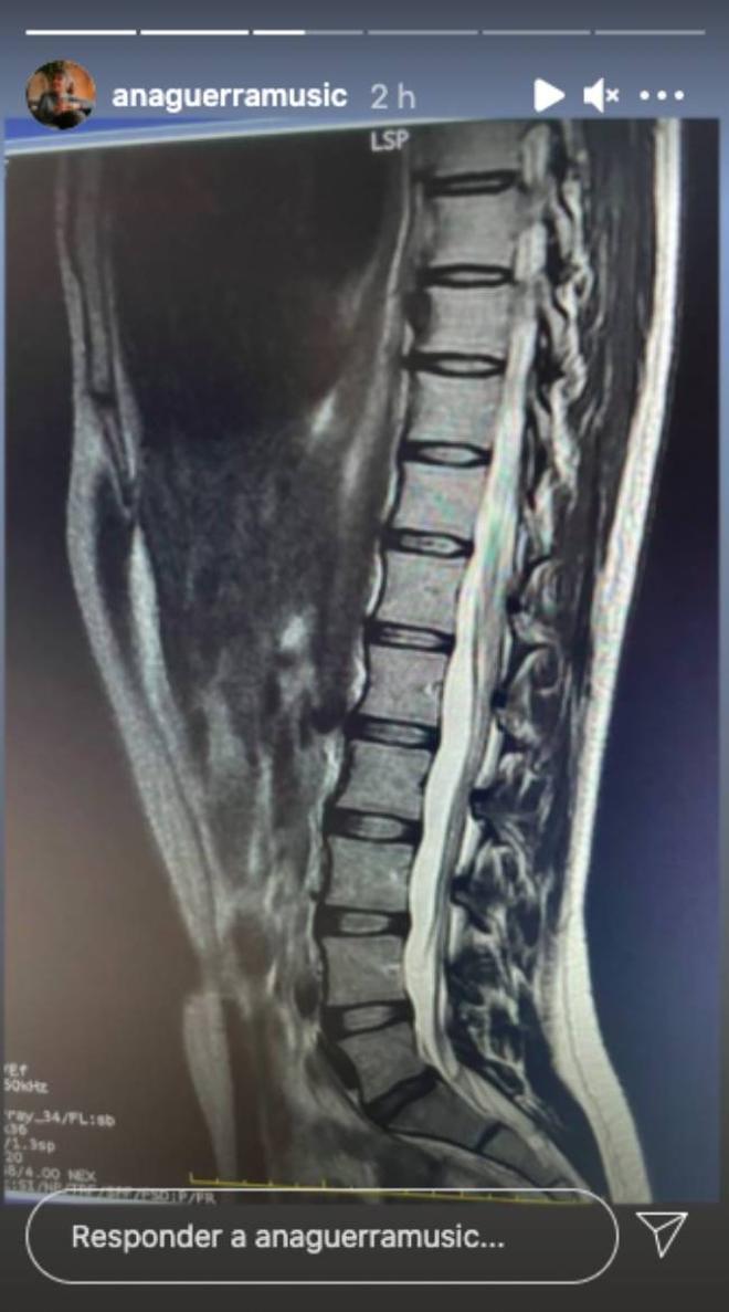 Ana Guerra comparte una foto de su resonancia magnética