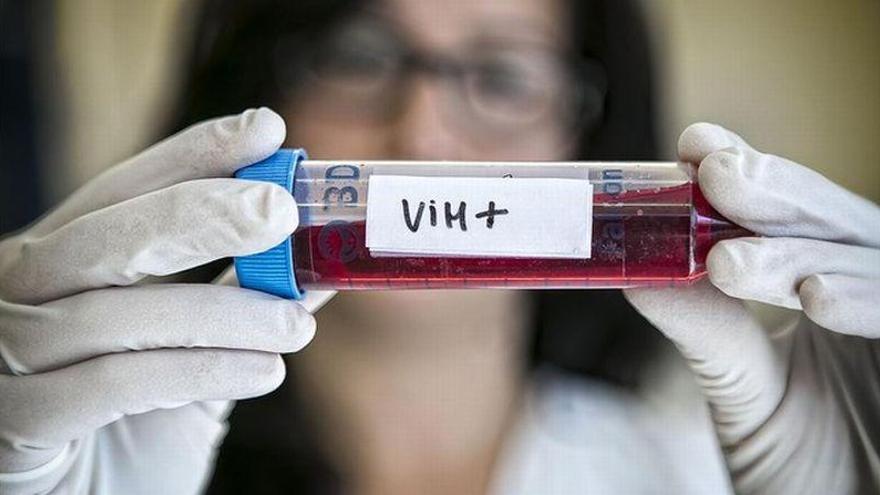 Una investigación afina qué tratamiento es mejor contra el VIH