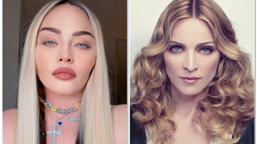 Madonna y sus rivales en la liga de las cirugías estéticas radicales