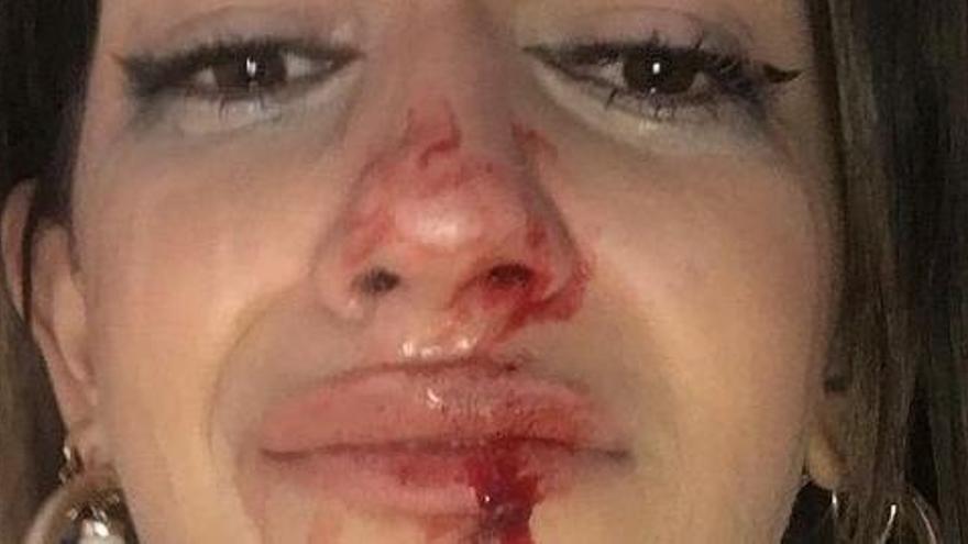 Una jove transsexual denuncia que ha estat &quot;brutalment agredida&quot; a Barcelona