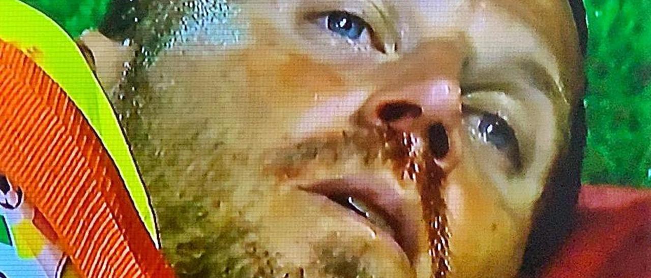 Primer plano de la cara de Dani Castellano tras recibir un balonazo en el pecho.