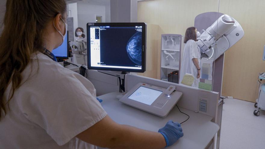 Creen un model per predir el risc individual de càncer de mama que obre la porta a una detecció més personalitzada