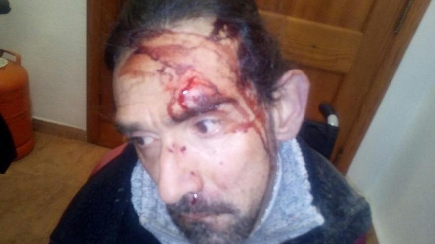 Investigan la agresión a un hombre con parálisis cerebral en València