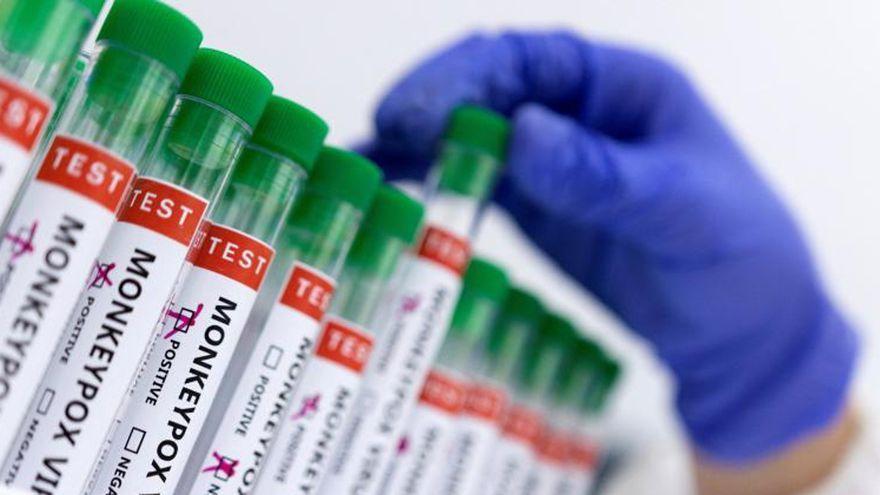 Llegan a España las 200 primeras vacunas contra la viruela del mono