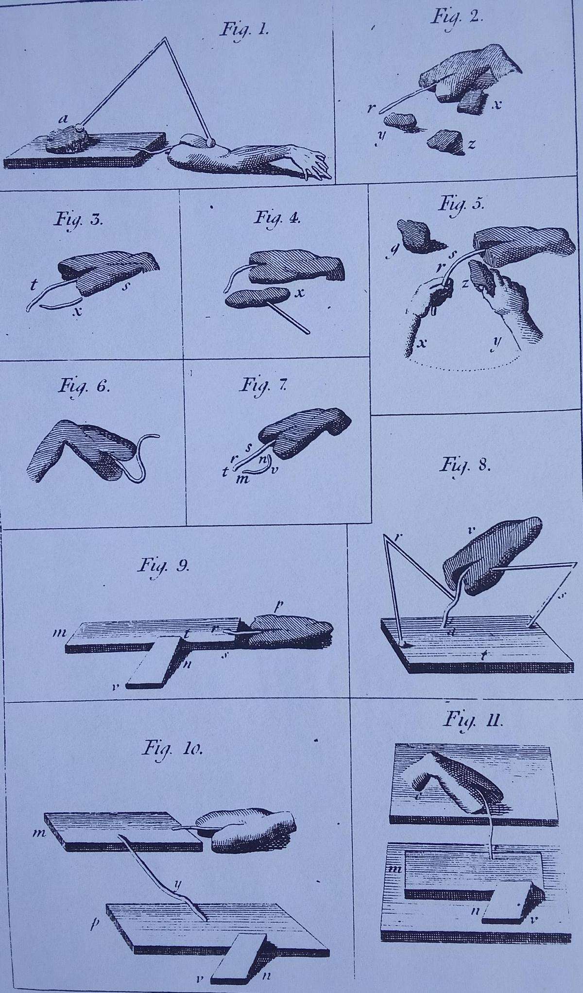 Unha das láminas dun libro de Humboldt sobre os experimentos galvánicos.
