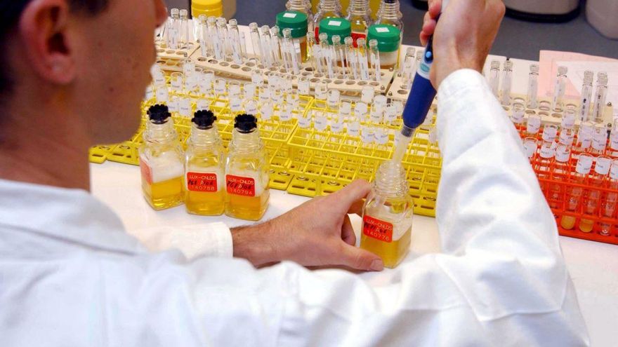 Una prueba de orina podría revelar cáncer de próstata en edad temprana, según un estudio