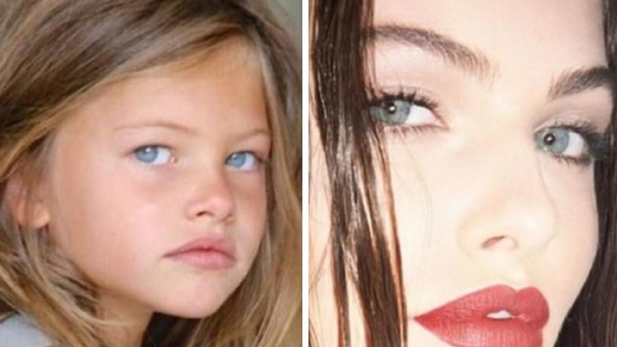 El antes y después de la niña más guapa del mundo.