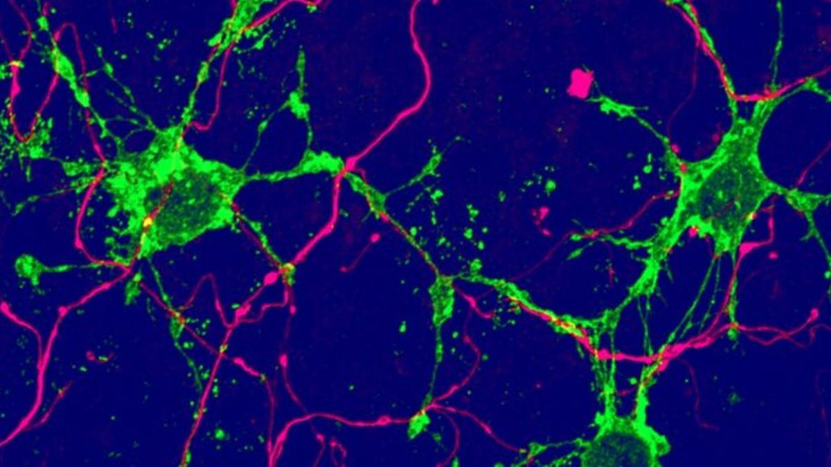Nuevas células gliales podrían reparar el cerebro