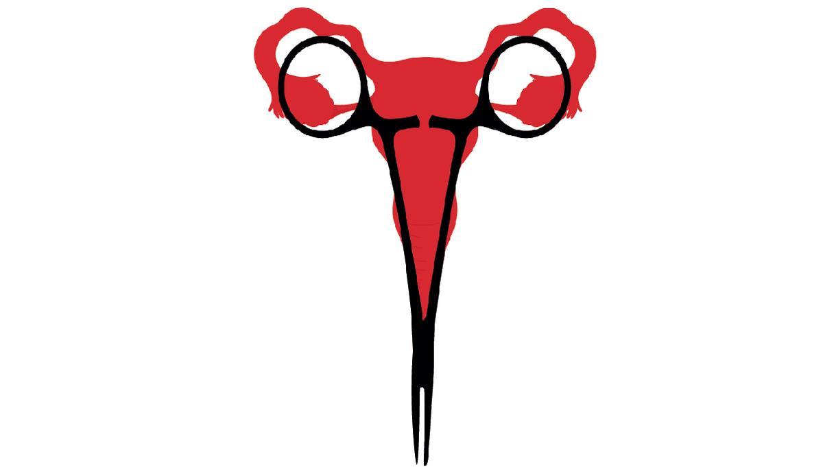Ilustración sobre el aborto