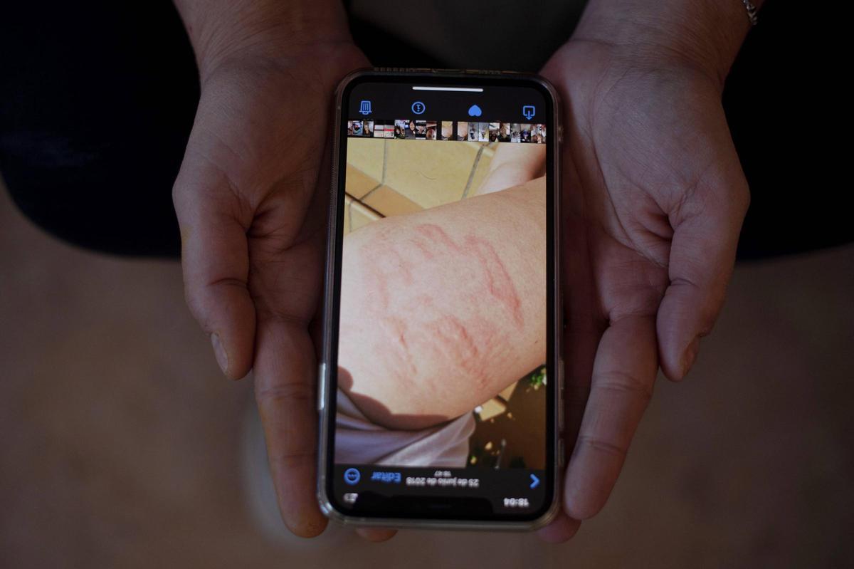 La hija mediana muestra una de las agresiones que sufrió a manos de su padre.