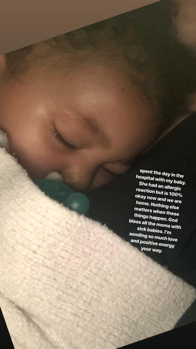 Stormi Webster alergia. Instagram @KylieJenner