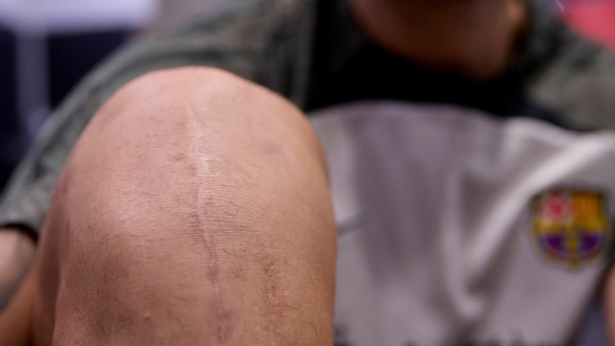 La rodilla derecha de Sergio Lozano