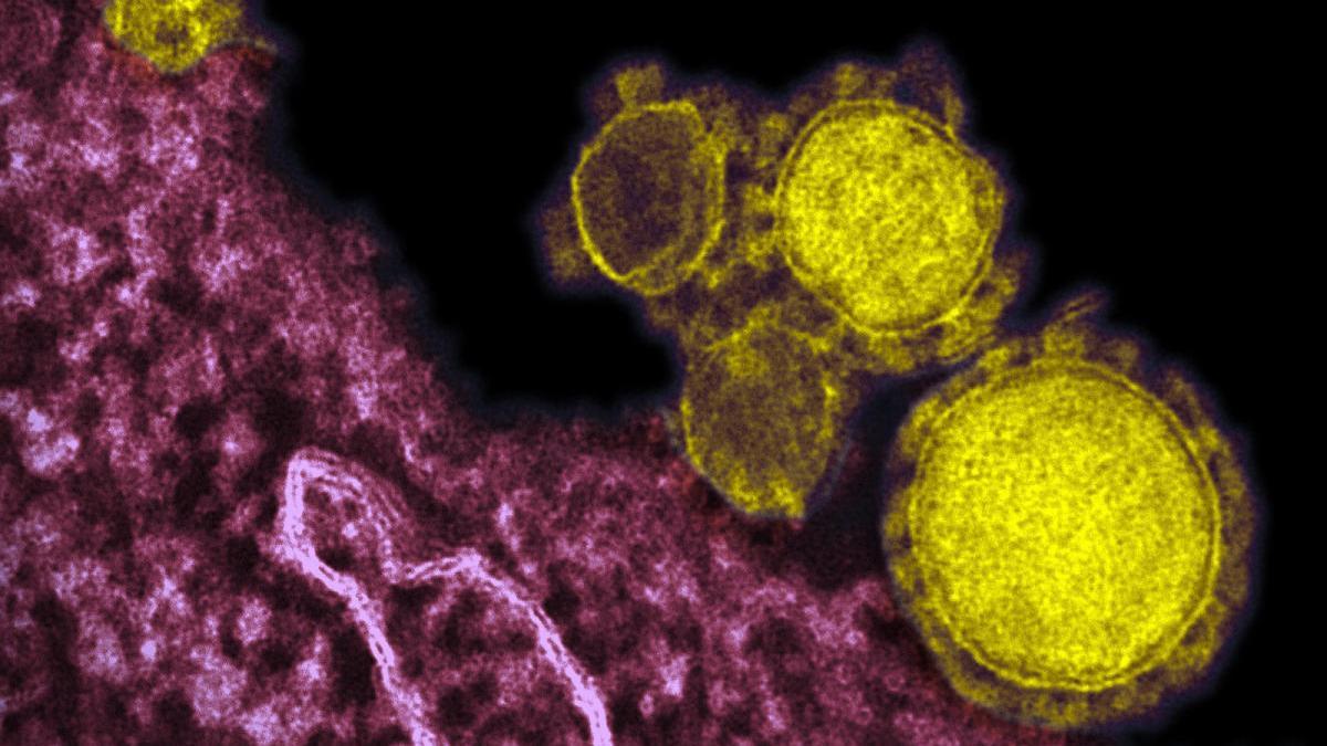 Imagen del virus a través del microscopio // FdV