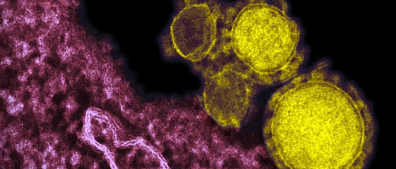 Ciencia gallega para anticiparse a un rebrote de coronavirus