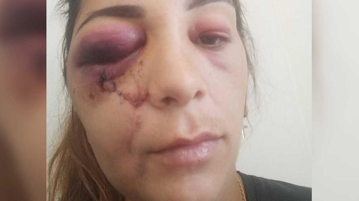 Desirée, la noia que va rebre l'impacte sortint a l'exterior de la discoteca de Girona