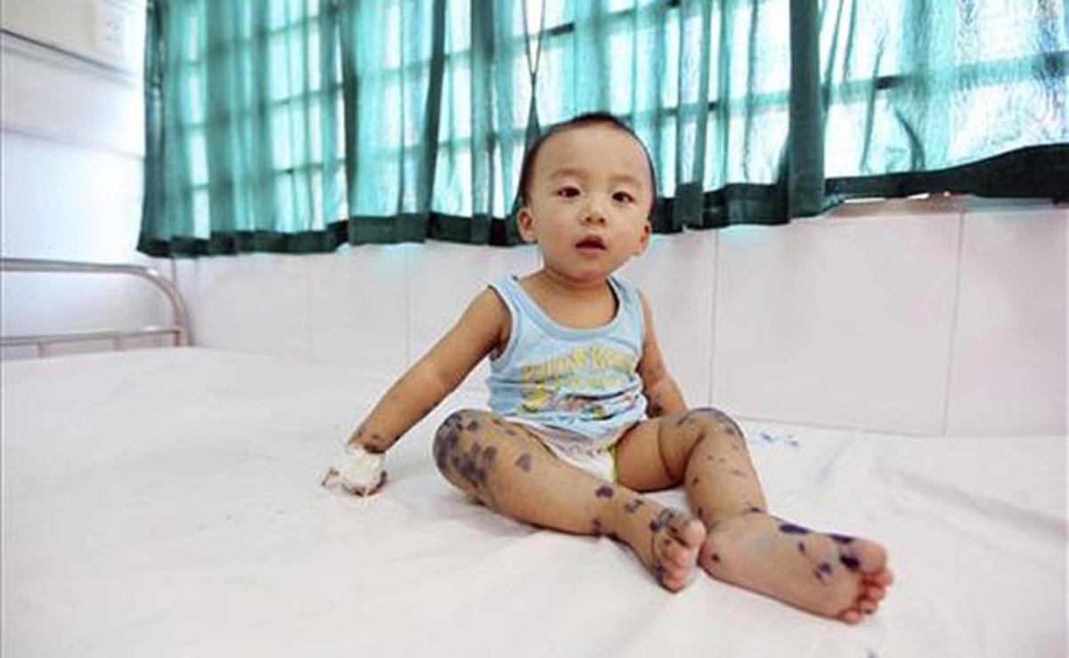 Dat, un nen vietnamita d’un any, és fotografiat a l’hospital pediàtric nacional de Hanoi (Vietnam).