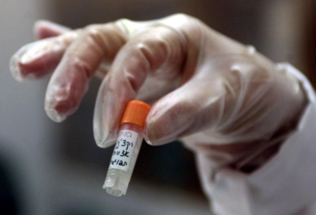 Espanya tenia dos milions de vacunes contra la verola el 2019 malgrat que la infecció no existia Espanya tenia dos milions de vacunes contra la verola el 2019 malgrat que la infecció no existia
